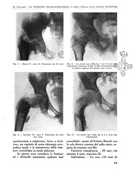 La chirurgia degli organi di movimento