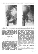 giornale/RML0015994/1935-1936/unico/00000193