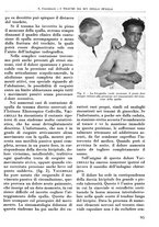 giornale/RML0015994/1937/unico/00000107