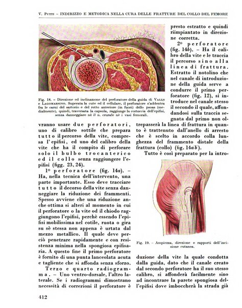 La chirurgia degli organi di movimento