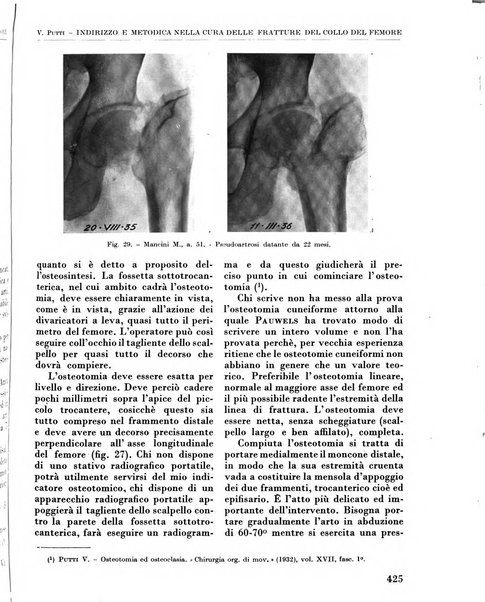 La chirurgia degli organi di movimento