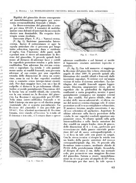 La chirurgia degli organi di movimento