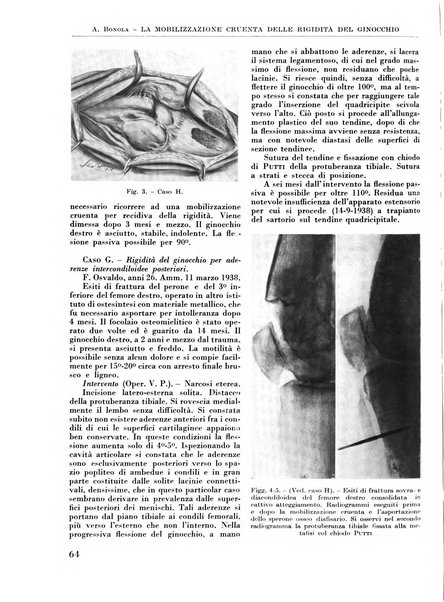 La chirurgia degli organi di movimento