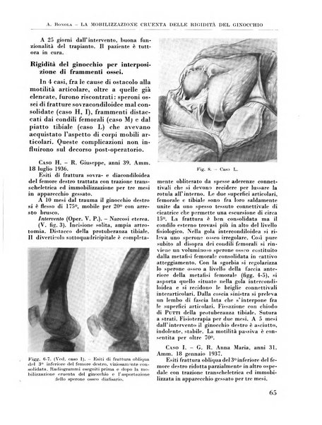 La chirurgia degli organi di movimento