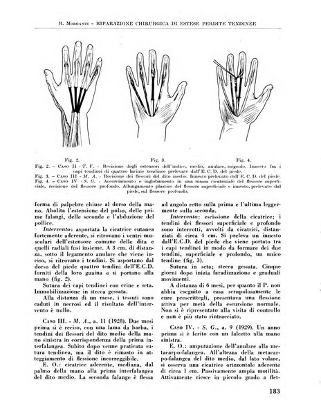 La chirurgia degli organi di movimento