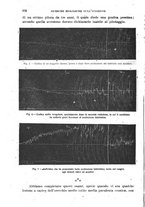 giornale/RML0017740/1919/unico/00000180