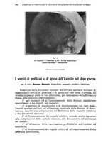 giornale/RML0017740/1922/unico/00000608