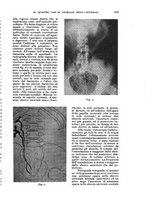 giornale/RML0017740/1935/unico/00000837