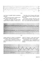 giornale/RML0020687/1936/unico/00000131