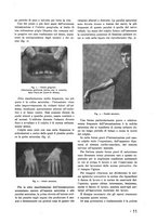 giornale/RML0021006/1937/unico/00000169