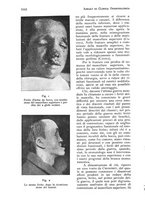 giornale/RML0023062/1932/unico/00001060