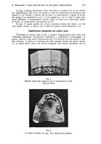 giornale/RML0023062/1934/unico/00000611
