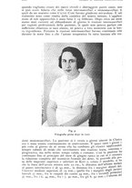 giornale/RML0023062/1934/unico/00001112
