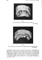 giornale/RML0023062/1935/unico/00000262