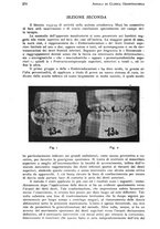 giornale/RML0023062/1935/unico/00000280