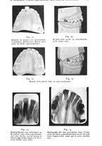 giornale/RML0023062/1935/unico/00000975