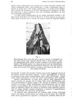 giornale/RML0023062/1937/unico/00000108