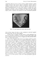 giornale/RML0023062/1937/unico/00000434
