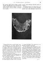 giornale/RML0023157/1939/unico/00000093