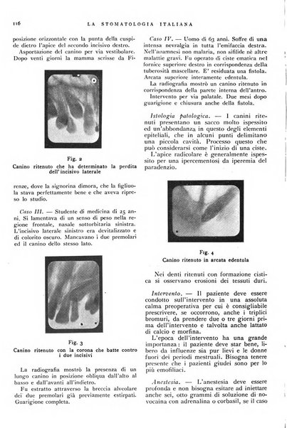 La stomatologia italiana organo ufficiale della Associazione nazionale culturale fascista stomato-odontologica