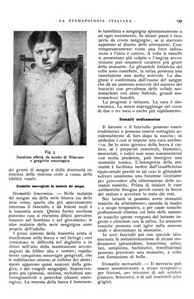 La stomatologia italiana organo ufficiale della Associazione nazionale culturale fascista stomato-odontologica