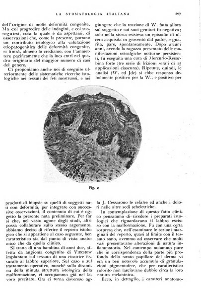 La stomatologia italiana organo ufficiale della Associazione nazionale culturale fascista stomato-odontologica