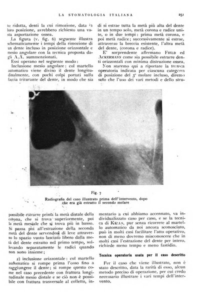 La stomatologia italiana organo ufficiale della Associazione nazionale culturale fascista stomato-odontologica