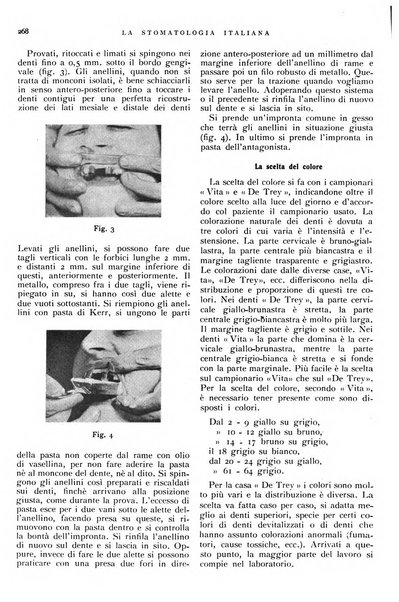 La stomatologia italiana organo ufficiale della Associazione nazionale culturale fascista stomato-odontologica