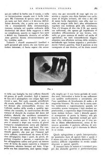 La stomatologia italiana organo ufficiale della Associazione nazionale culturale fascista stomato-odontologica