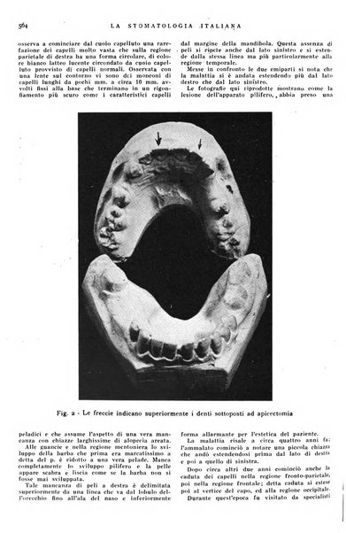 La stomatologia italiana organo ufficiale della Associazione nazionale culturale fascista stomato-odontologica