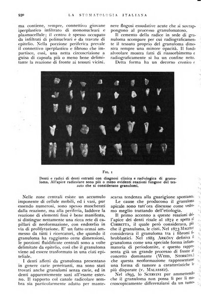 La stomatologia italiana organo ufficiale della Associazione nazionale culturale fascista stomato-odontologica