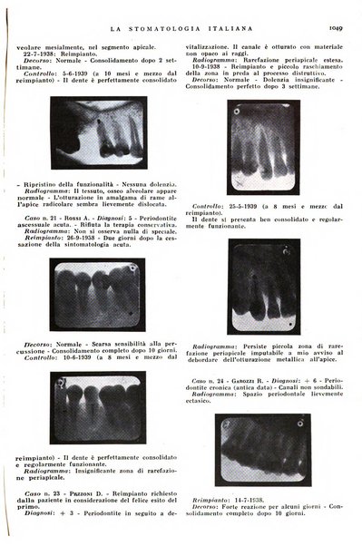 La stomatologia italiana organo ufficiale della Associazione nazionale culturale fascista stomato-odontologica