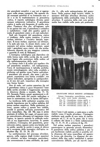 La stomatologia italiana organo ufficiale della Associazione nazionale culturale fascista stomato-odontologica