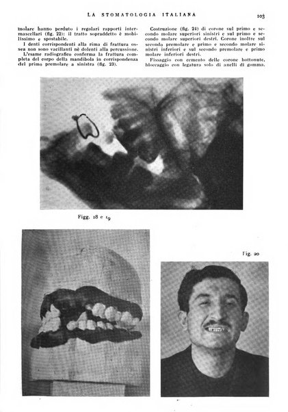 La stomatologia italiana organo ufficiale della Associazione nazionale culturale fascista stomato-odontologica