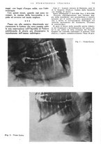 giornale/RML0023157/1940/unico/00000127