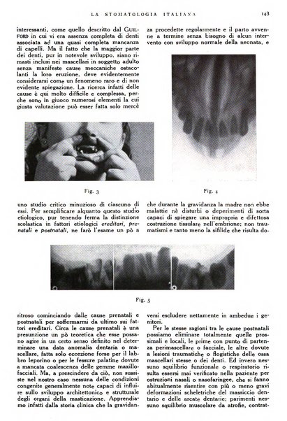 La stomatologia italiana organo ufficiale della Associazione nazionale culturale fascista stomato-odontologica