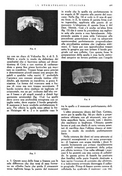 La stomatologia italiana organo ufficiale della Associazione nazionale culturale fascista stomato-odontologica