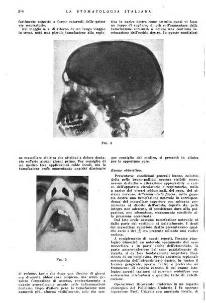 La stomatologia italiana organo ufficiale della Associazione nazionale culturale fascista stomato-odontologica