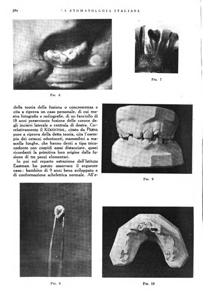 La stomatologia italiana organo ufficiale della Associazione nazionale culturale fascista stomato-odontologica