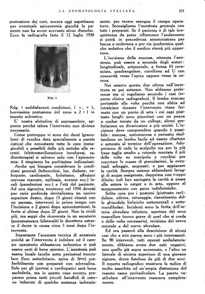 La stomatologia italiana organo ufficiale della Associazione nazionale culturale fascista stomato-odontologica