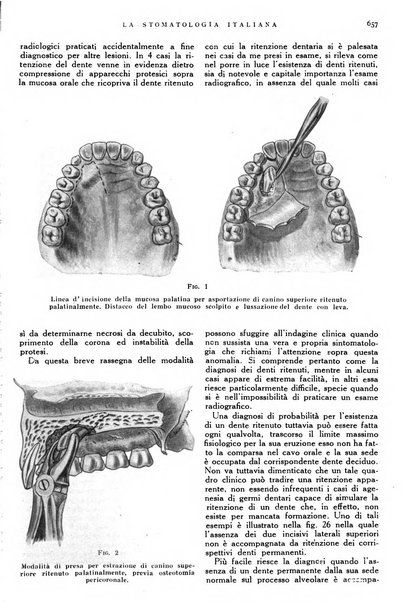 La stomatologia italiana organo ufficiale della Associazione nazionale culturale fascista stomato-odontologica