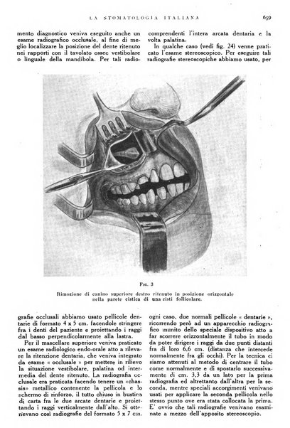 La stomatologia italiana organo ufficiale della Associazione nazionale culturale fascista stomato-odontologica