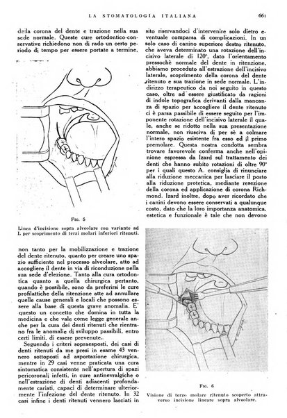 La stomatologia italiana organo ufficiale della Associazione nazionale culturale fascista stomato-odontologica