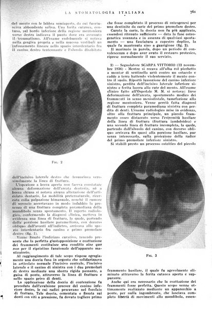 La stomatologia italiana organo ufficiale della Associazione nazionale culturale fascista stomato-odontologica