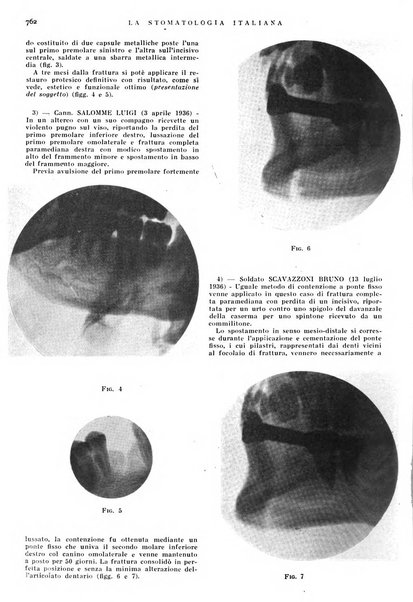 La stomatologia italiana organo ufficiale della Associazione nazionale culturale fascista stomato-odontologica