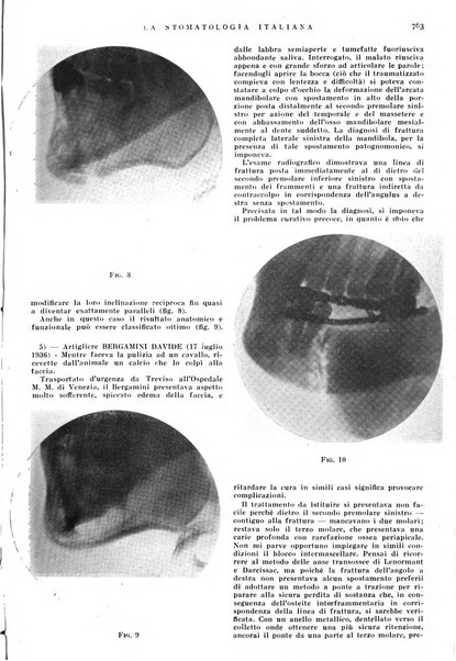 La stomatologia italiana organo ufficiale della Associazione nazionale culturale fascista stomato-odontologica