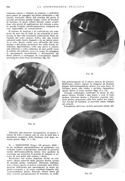 La stomatologia italiana organo ufficiale della Associazione nazionale culturale fascista stomato-odontologica