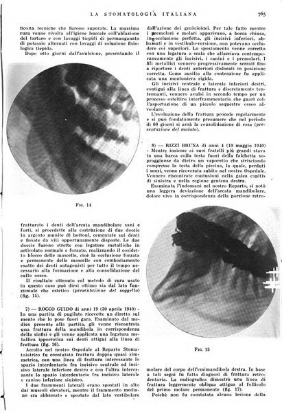 La stomatologia italiana organo ufficiale della Associazione nazionale culturale fascista stomato-odontologica