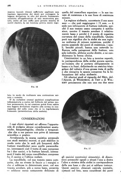 La stomatologia italiana organo ufficiale della Associazione nazionale culturale fascista stomato-odontologica