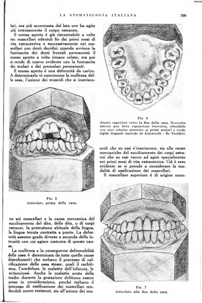 La stomatologia italiana organo ufficiale della Associazione nazionale culturale fascista stomato-odontologica